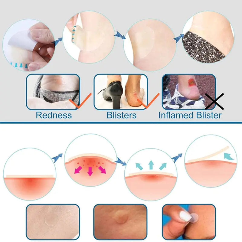 Blandet vandtæt hydrocolloid plaster til fod med klæbende blisterbeskyttelse